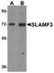 Lymphocyte Antigen 9 antibody, A05830-2, Boster Biological Technology, Western Blot image 