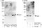 Transcription Factor 25 antibody, A303-087A, Bethyl Labs, Immunoprecipitation image 