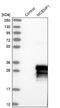 C19orf59 antibody, NBP1-81253, Novus Biologicals, Western Blot image 