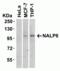 NLR Family Pyrin Domain Containing 6 antibody, GTX85157, GeneTex, Western Blot image 