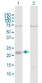 Interferon Epsilon antibody, H00338376-D01P, Novus Biologicals, Western Blot image 