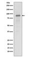 Heat Shock Protein 90 Alpha Family Class A Member 1 antibody, M01103, Boster Biological Technology, Western Blot image 