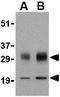 SCO Cytochrome C Oxidase Assembly Protein 1 antibody, GTX85056, GeneTex, Western Blot image 