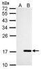 NME/NM23 Nucleoside Diphosphate Kinase 4 antibody, GTX107431, GeneTex, Western Blot image 