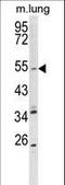 Potassium Voltage-Gated Channel Subfamily Q Member 1 antibody, LS-B9899, Lifespan Biosciences, Western Blot image 