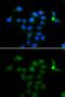 Tyrosine Aminotransferase antibody, GTX64477, GeneTex, Immunocytochemistry image 