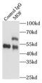 Lysine Acetyltransferase 8 antibody, FNab05266, FineTest, Immunoprecipitation image 