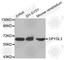 Dihydropyrimidinase Like 3 antibody, A3834, ABclonal Technology, Western Blot image 