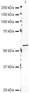Cytochrome P450 Family 19 Subfamily A Member 1 antibody, PA5-19633, Invitrogen Antibodies, Western Blot image 