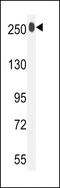 Latent Transforming Growth Factor Beta Binding Protein 1 antibody, 63-200, ProSci, Western Blot image 