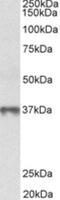 Methionine Adenosyltransferase 2B antibody, NBP2-26144, Novus Biologicals, Western Blot image 