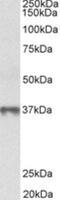 Methionine adenosyltransferase 2 subunit beta antibody, NBP2-26144, Novus Biologicals, Western Blot image 