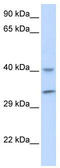 AlkB Homolog 3, Alpha-Ketoglutaratedependent Dioxygenase antibody, TA333528, Origene, Western Blot image 