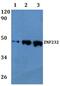 Zinc Finger Protein 232 antibody, PA5-75855, Invitrogen Antibodies, Western Blot image 