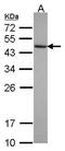 Cytohesin 3 antibody, PA5-30307, Invitrogen Antibodies, Western Blot image 