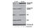 AKT Serine/Threonine Kinase 2 antibody, 8599S, Cell Signaling Technology, Western Blot image 