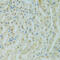 Regulator Of Chromosome Condensation 1 antibody, 22-147, ProSci, Immunohistochemistry paraffin image 