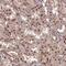 Centrosomal Protein 83 antibody, NBP1-90690, Novus Biologicals, Immunohistochemistry frozen image 