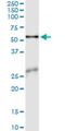 Asparagine Synthetase (Glutamine-Hydrolyzing) antibody, H00000440-M02, Novus Biologicals, Immunoprecipitation image 