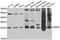 Methionine Sulfoxide Reductase A antibody, A04413, Boster Biological Technology, Western Blot image 