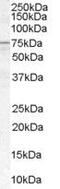 Acyl-CoA Synthetase Long Chain Family Member 5 antibody, PA5-18515, Invitrogen Antibodies, Western Blot image 