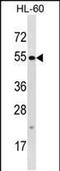 Tetratricopeptide Repeat Domain 34 antibody, PA5-48802, Invitrogen Antibodies, Western Blot image 