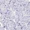 Islet Amyloid Polypeptide antibody, NBP2-33680, Novus Biologicals, Immunohistochemistry paraffin image 