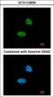 Poly(ADP-Ribose) Polymerase 1 antibody, LS-C109356, Lifespan Biosciences, Immunofluorescence image 
