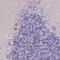 Phosphatidylinositol Glycan Anchor Biosynthesis Class M antibody, NBP2-13761, Novus Biologicals, Immunohistochemistry paraffin image 