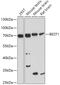 Bestrophin 1 antibody, GTX64583, GeneTex, Western Blot image 