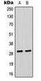 Chloride Intracellular Channel 4 antibody, orb224088, Biorbyt, Western Blot image 