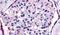 F2R Like Trypsin Receptor 1 antibody, PA5-33527, Invitrogen Antibodies, Immunohistochemistry paraffin image 