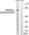 P21 (RAC1) Activated Kinase 5 antibody, LS-C199410, Lifespan Biosciences, Western Blot image 