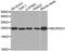 Neurogenin 1 antibody, A3110, ABclonal Technology, Western Blot image 