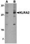Killer cell lectin-like receptor 2 antibody, orb75143, Biorbyt, Western Blot image 