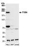 Integrin Subunit Beta 4 antibody, A305-203A, Bethyl Labs, Western Blot image 