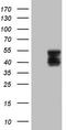 Tissue Factor Pathway Inhibitor antibody, LS-B12668, Lifespan Biosciences, Western Blot image 
