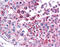 MAGE-3 antigen antibody, ARP46123_P050, Aviva Systems Biology, Immunohistochemistry frozen image 