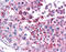 MAGE Family Member A3 antibody, ARP46123_P050, Aviva Systems Biology, Immunohistochemistry frozen image 