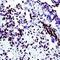 WT1 Transcription Factor antibody, PA1-38865, Invitrogen Antibodies, Immunohistochemistry paraffin image 