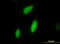 Ribosomal Protein S6 Kinase A3 antibody, LS-C198121, Lifespan Biosciences, Immunofluorescence image 