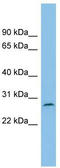RUN And SH3 Domain Containing 1 antibody, TA334977, Origene, Western Blot image 