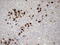 Zinc Finger Protein 35 antibody, M13171-1, Boster Biological Technology, Immunohistochemistry paraffin image 