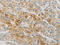 Acyl-CoA Synthetase Long Chain Family Member 4 antibody, CSB-PA289963, Cusabio, Immunohistochemistry paraffin image 