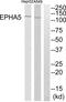 EPH Receptor A5 antibody, abx015159, Abbexa, Western Blot image 