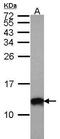 S100A10 antibody, PA5-27251, Invitrogen Antibodies, Western Blot image 