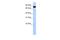 EMAP Like 3 antibody, PA5-70124, Invitrogen Antibodies, Western Blot image 