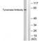 Tyrosinase antibody, A00326, Boster Biological Technology, Western Blot image 