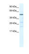 Heat Shock Transcription Factor Y-Linked 2 antibody, MBS835438, MyBioSource, Western Blot image 