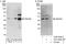 Zinc Finger Protein 444 antibody, A303-269A, Bethyl Labs, Western Blot image 